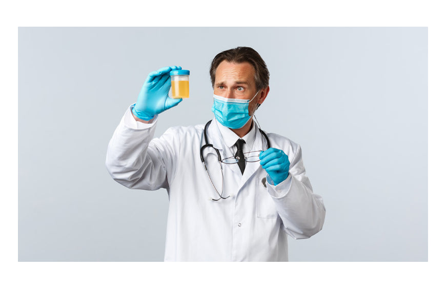 elfbar nachfüll pod läuft aus Combien de temps le CBD reste dans l'urine ? main image 1