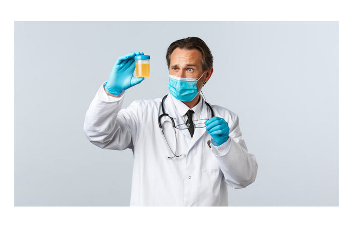 CBD et test d’urine : des risques d’obtenir un résultat positif ?